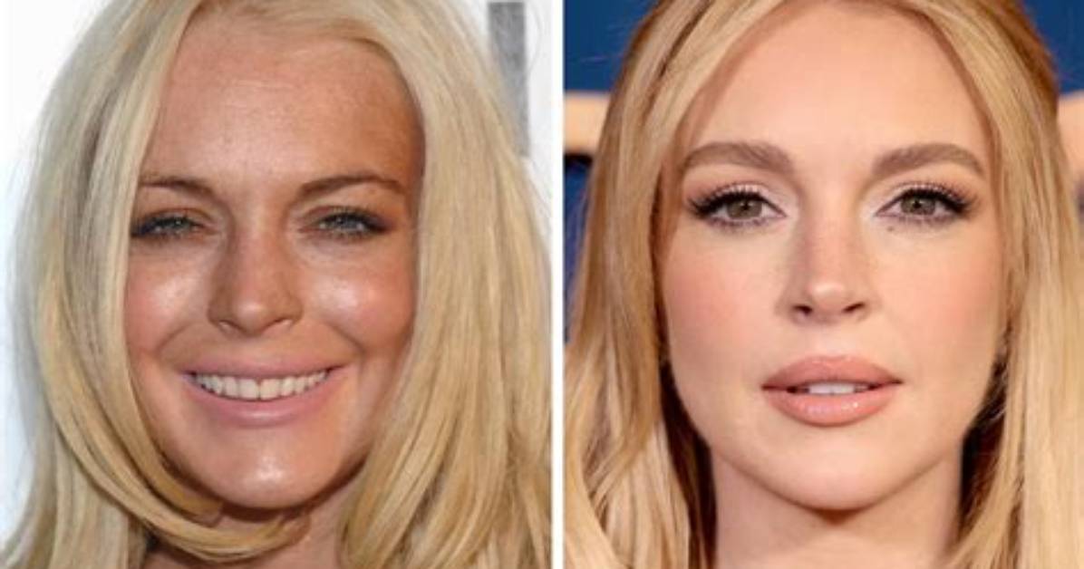 Lindsay Lohan's Face Transformation: Uncovering the Truth