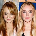 Lindsay Lohan's Plastic Surgery Journey