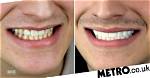 Love Island Luca Bish Teeth Before Coming to the Show: Has He Whitened Them