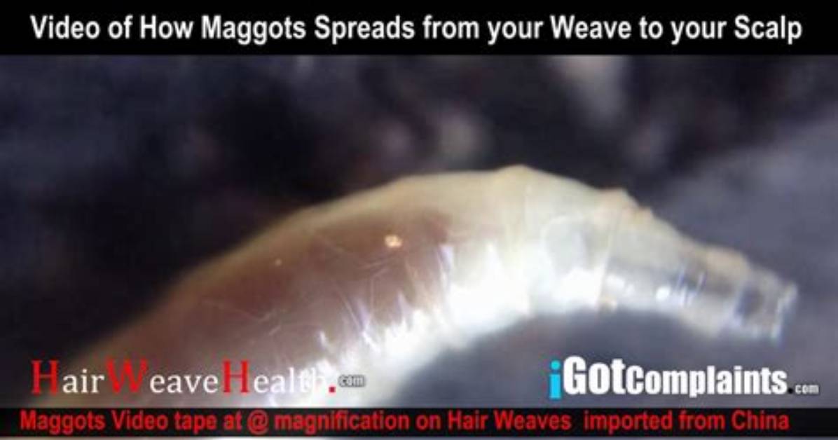 Maggots in Hair Extensions: a Shocking Health Hazard