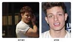 Matt Rife's Teeth: a Unique Comedy Catalyst