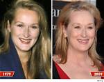 Meryl Streep's Plastic Surgery: Unveiling the Enigma