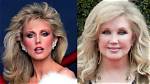 Morgan Fairchild Biography, Net Worth, Plastic Surgery, How Old Is She?