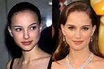Natalie Portman Nose Job Plastic Surgery Before And