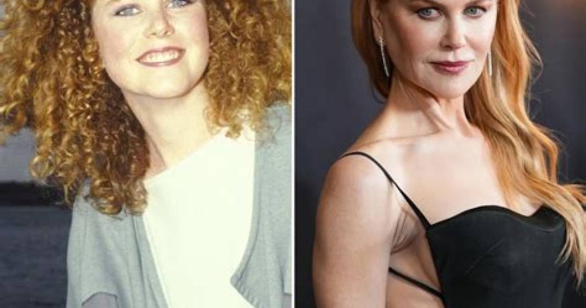 Nicole Kidman: a Glimpse into Her Cosmetic Journey