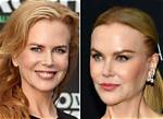 Nicole Kidman's Plastic Surgery: a Complete Guide to Her Transformations
