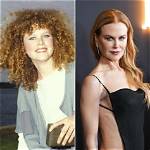 Nicole Kidman's Transformation: Before and After Fillers