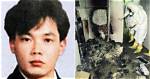 Photos: Hisashi Ouchi - the Corpse Man Who Survived Nuclear Radiation