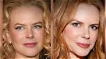 Plastic Surgery Secrets of Nicole Kidman: the Ultimate Transformation