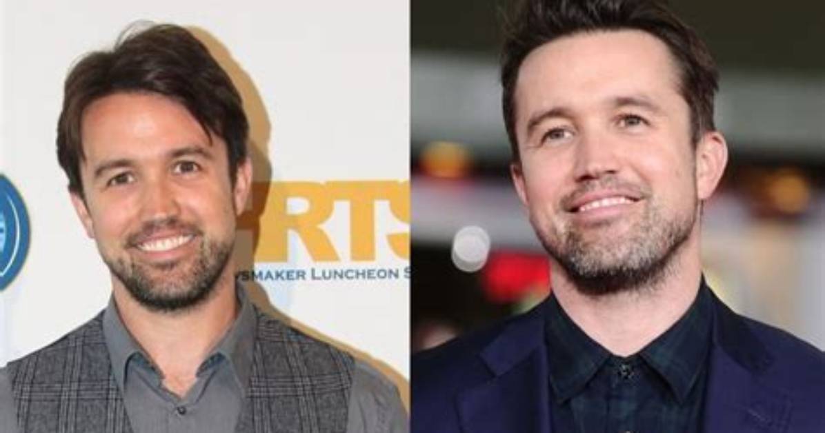 Rob Mcelhenney Plastic Surgery Before and After
