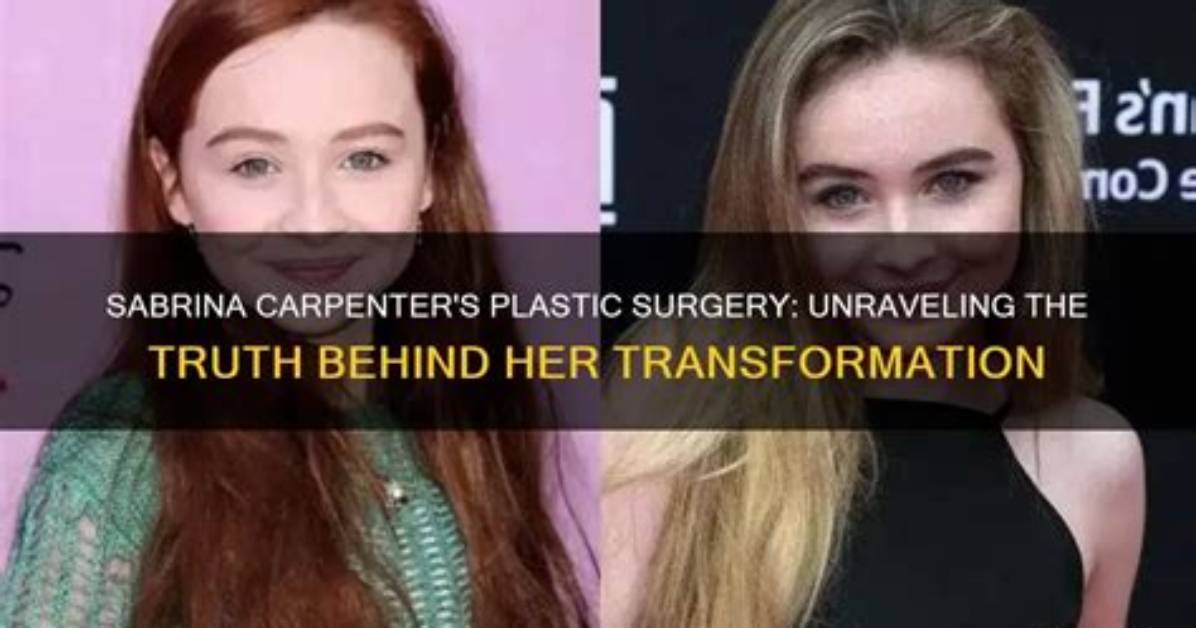 Sabrina Carpenter: the Truth Behind the Plastic Surgery Rumors
