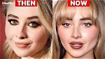 Sabrina's Plastic Surgery Transformation: Before and After Photos.