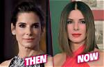 Sandra Bullock's Plastic Surgery Journey Explored