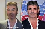 Simon Cowell: Overcoming Adversity and Disability
