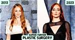 Sophie Turner Plastic Surgery: Sophie's Clear Admission or Straight Denial?