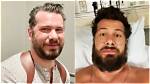 Steven Crowder Surgery: Unlocking Medical Breakthroughs and Patient Triumphs