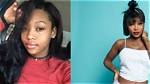 Summer Walker Before Plastic Surgery
