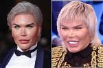 The Living Human Ken Doll and His Journey