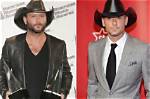 Tim Mcgraw Plastic Surgery: the Truth Behind the Transformation
