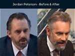 Transformative Journey: Jordan Peterson Before and After Carnivore Diet