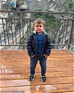 Uncover the Type of Dwarfism Affecting Hasbulla