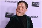 Understanding Adam Pearson's Girlfriend: a Deep Dive into His Personal Life