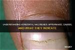 Understanding Horizontal Ridges on Toenails: What They Indicate About Your Health