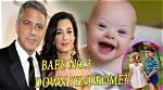 Understanding the Truth: Does George Clooney's Son Have Downs?