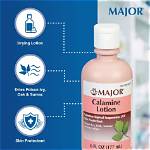 Unlock the Secrets of Calamine Lotion for Ringworm: Discoveries and Insights