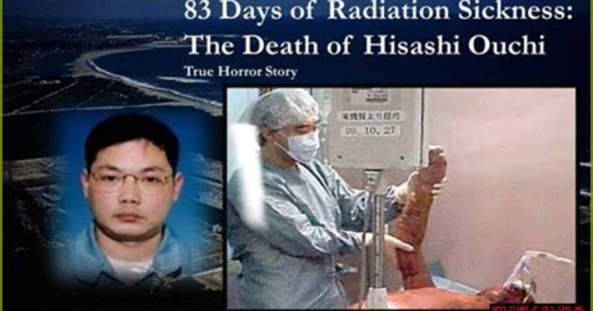 Unraveling the Tragic Tale of Hisashi Ouchi's Last Days