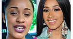 Unveiling Cardi B's Teeth Transformation: Before and After