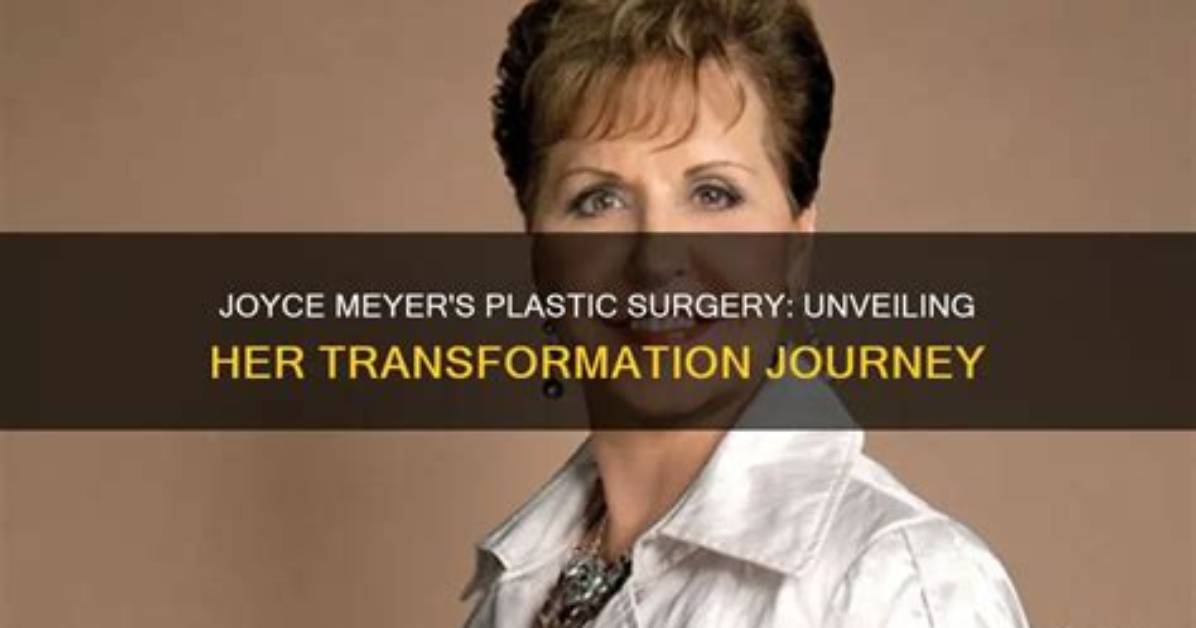 Unveiling Joyce Meyers' Plastic Surgery Journey: Exploring Choices and Impacts
