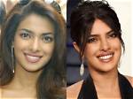 Unveiling Priyanka Chopra's Transformation: Discoveries Before Nose Surgery