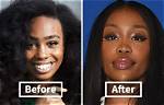 Unveiling Sza's Journey: Cosmetic Surgery and Self-Acceptance