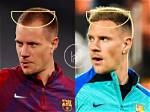 Unveiling the Enigma of Ter Stegen Pelo