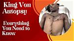 Unveiling the Mystery: King Von Autopsy Pic