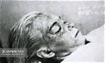 Unveiling the Secrets: Marilyn Monroe Autopsy Photos