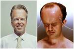 Unveiling the Secrets of "Biggest Forehead": Discoveries and Insights