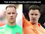 Unveiling the Style: Ter Stegen Pelo