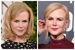 Unveiling the Truth About Nicole Kidman Plastic Surgery