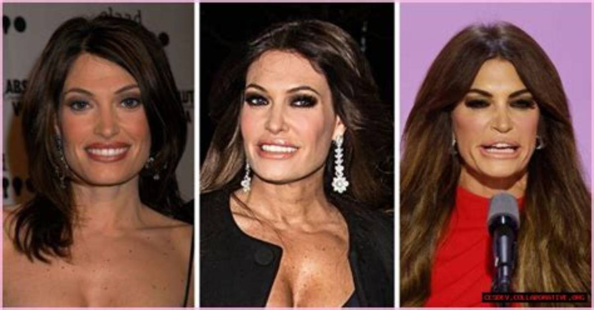 Unveiling the Truth: Kimberly Guilfoyle and the Transgender Conversation