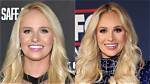 Unveiling Tomi Lahren's Transformation: Pre-Surgery Revelations