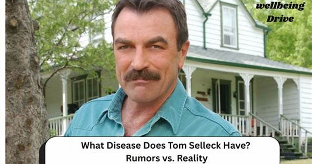 What Disease Does Tom Selleck Have? Unraveling the Mystery