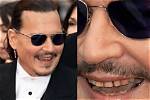 What Happened to Johnny Depps Teeth? |