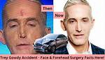 What Happened to Trey Gowdy's Nose? Unraveling the Mystery