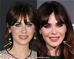 Zooey Deschanel Plastic Surgery: Did She Really Change Her Face?